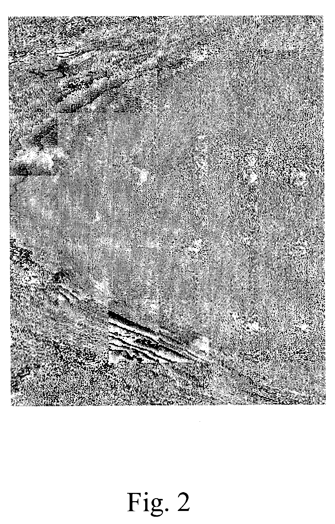 Method and system for compressing a continuous data flow in real-time using cluster successive approximation multi-stage vector quantization (SAMVQ)