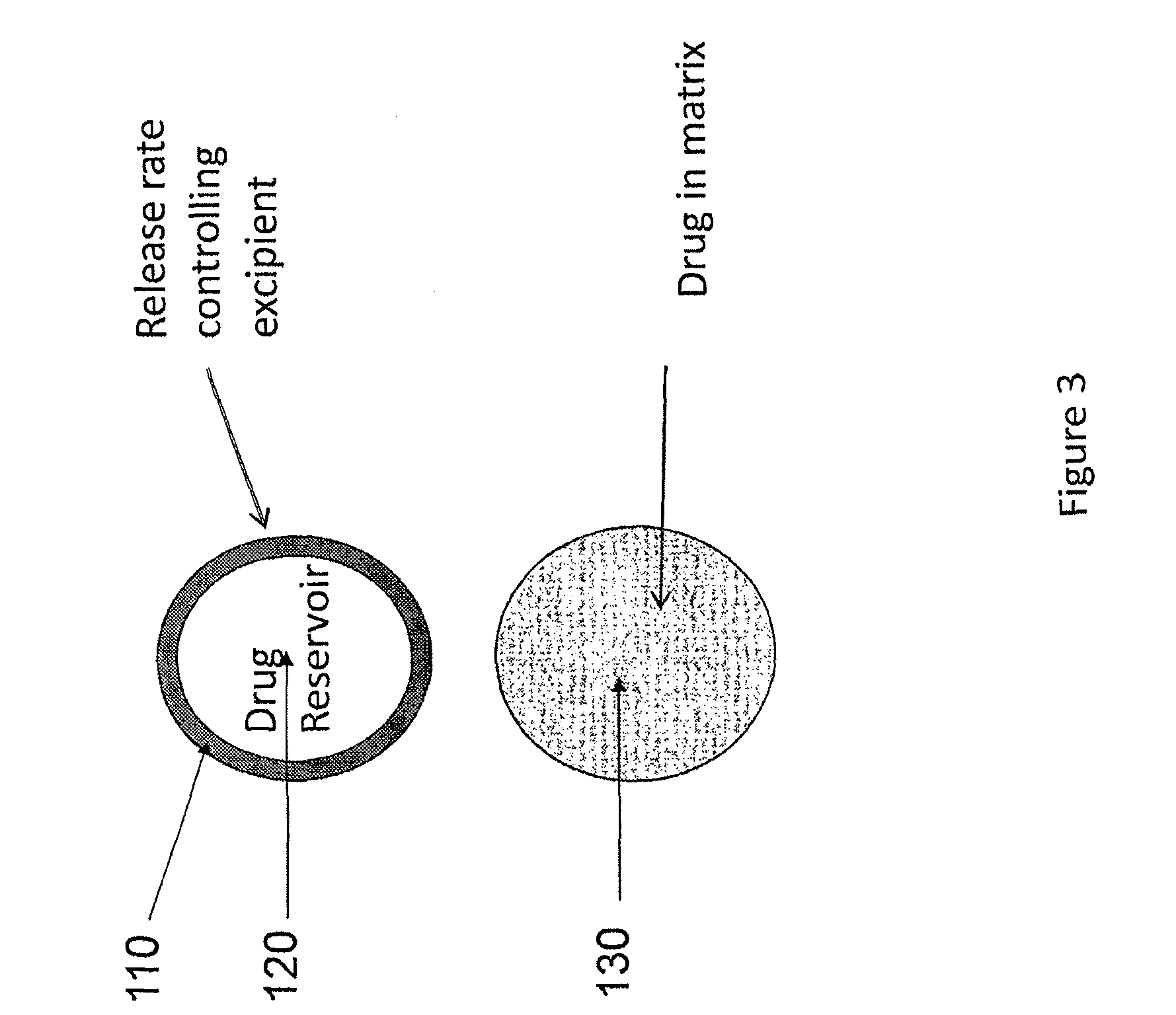 Implantable tizanidine compositions and methods of treatment thereof