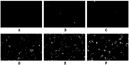 Stem cell preparation against malignant melanoma and preparation method thereof