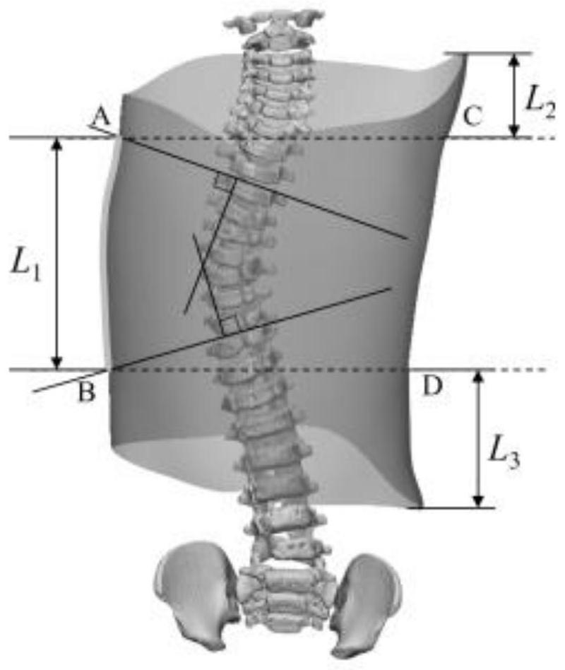 Method for measuring scoliosis orthopedic force
