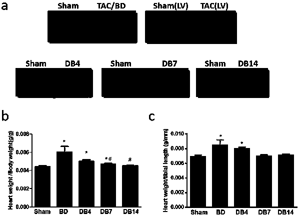 Method for constructing cardiac pressure overload/unloading mouse model