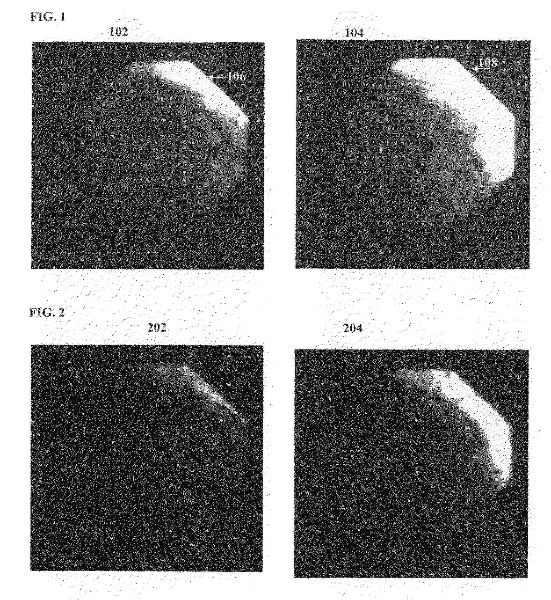 Method and system for scale-based vessel enhancement in X-ray angiography