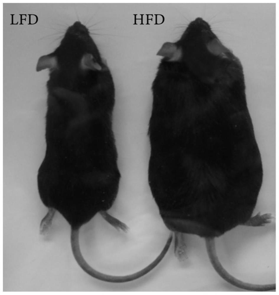 Construction method of non-alcoholic fatty liver mouse model