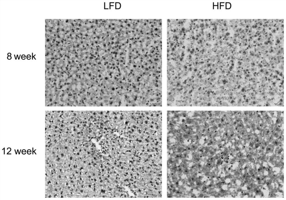 Construction method of non-alcoholic fatty liver mouse model