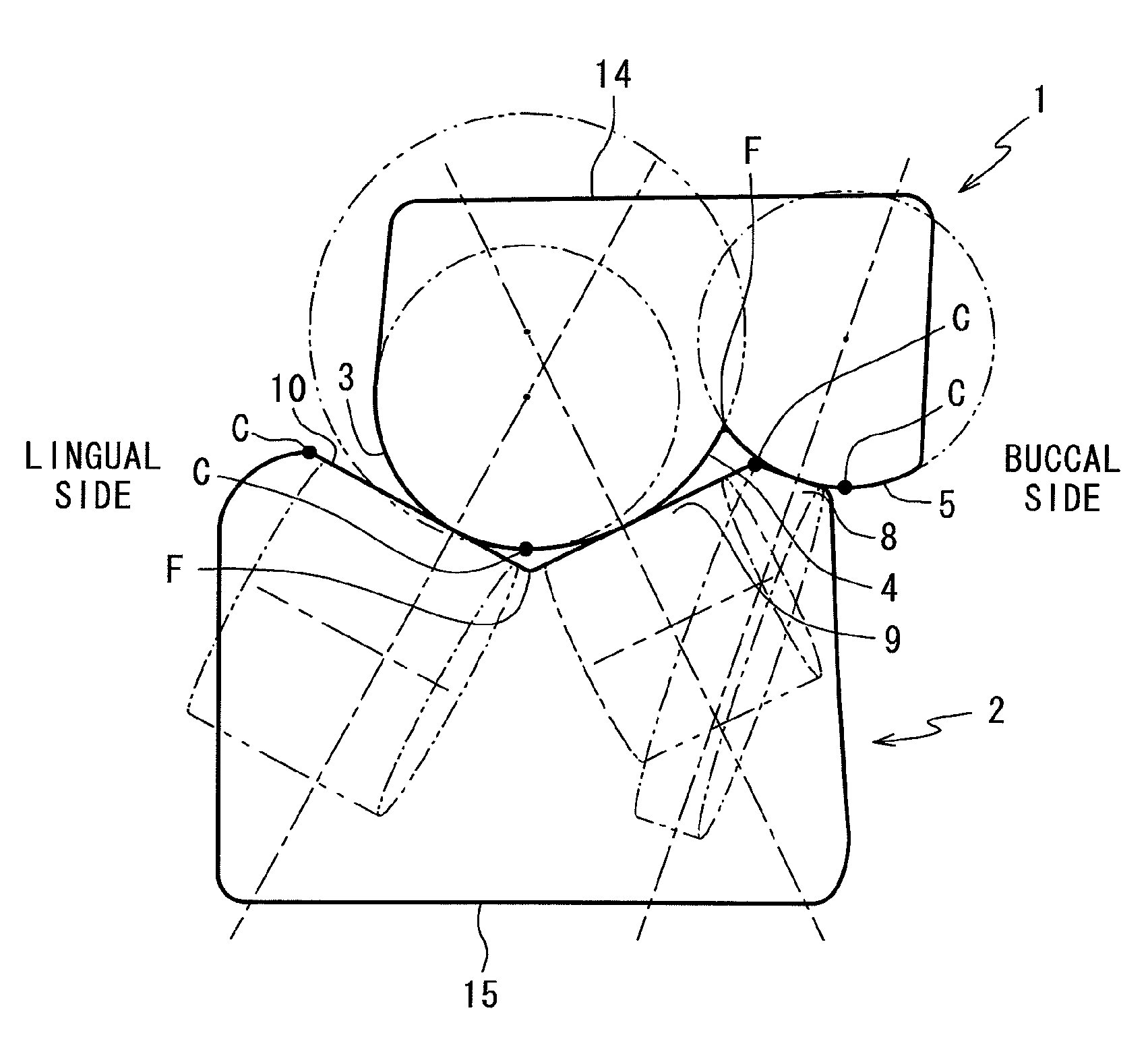 Set of artificial teeth having convex adjustment surface