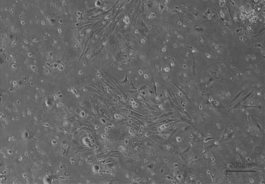 In vitro culture method for scatophagus argus kidney cells