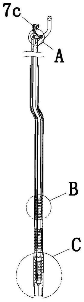Injection ligation endoscope for gastric polyps