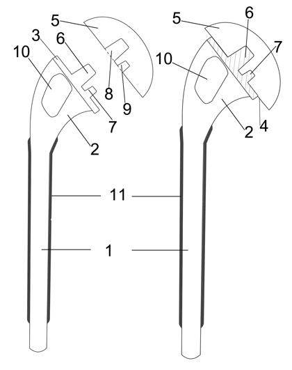 Design method for tantalum coating artificial shoulder prosthesis