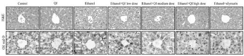 Medicine for preventing and treating alcoholic liver diseases and extraction method