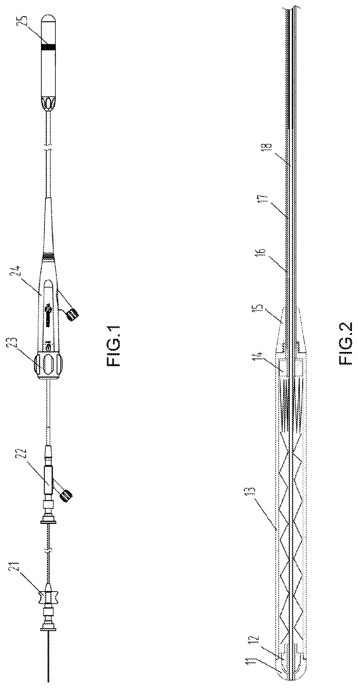 Gastric diverter and digestive tract support and release method thereof