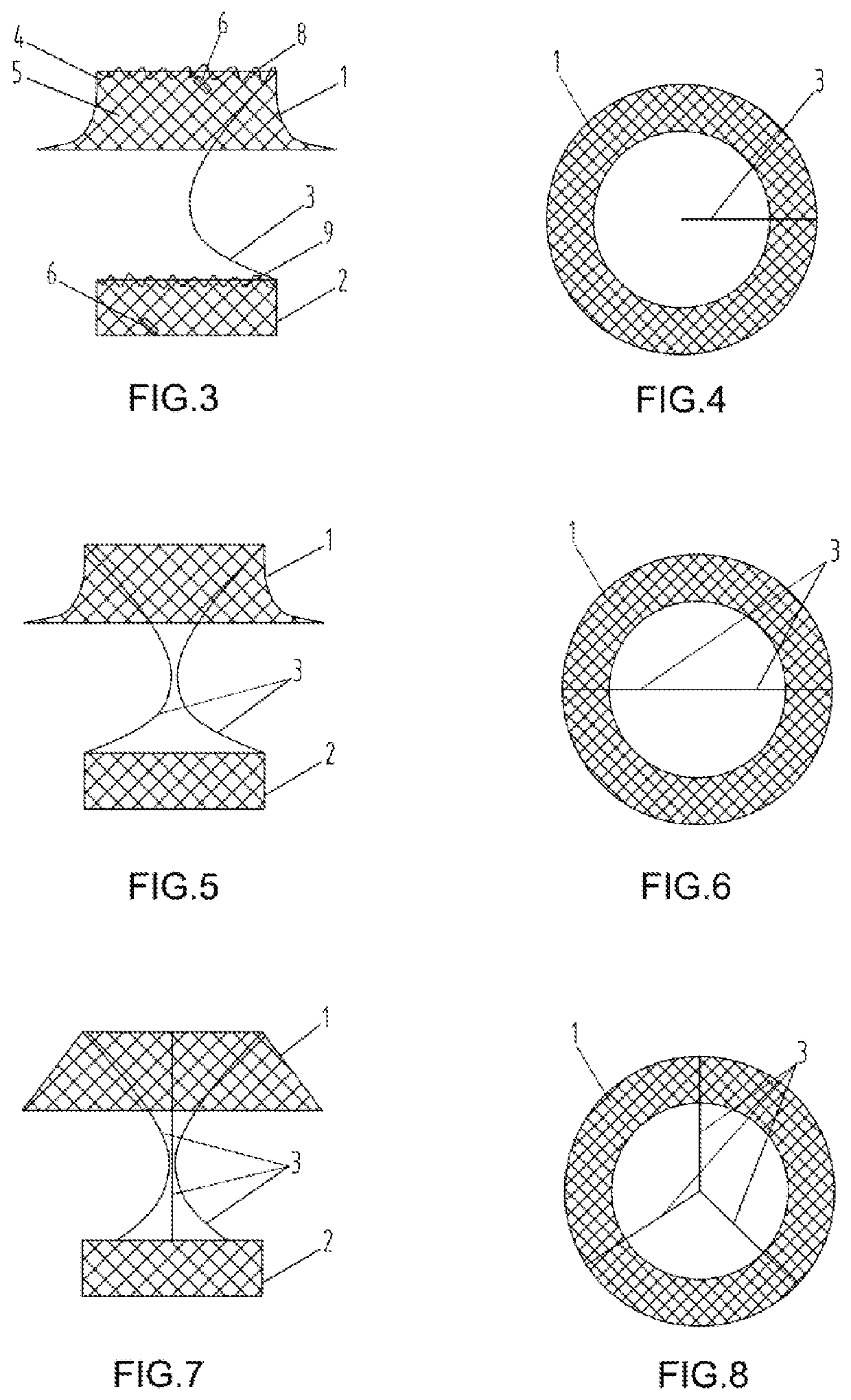 Gastric diverter and digestive tract support and release method thereof