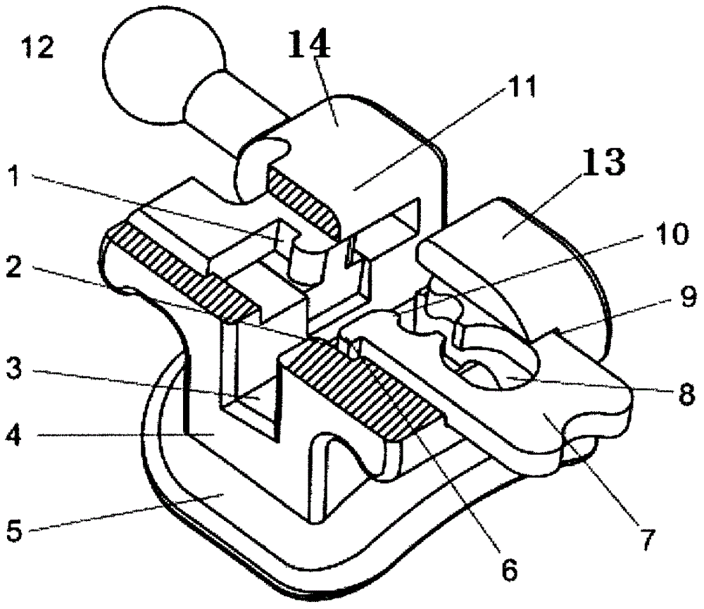 Orthodontic self-ligating bracket