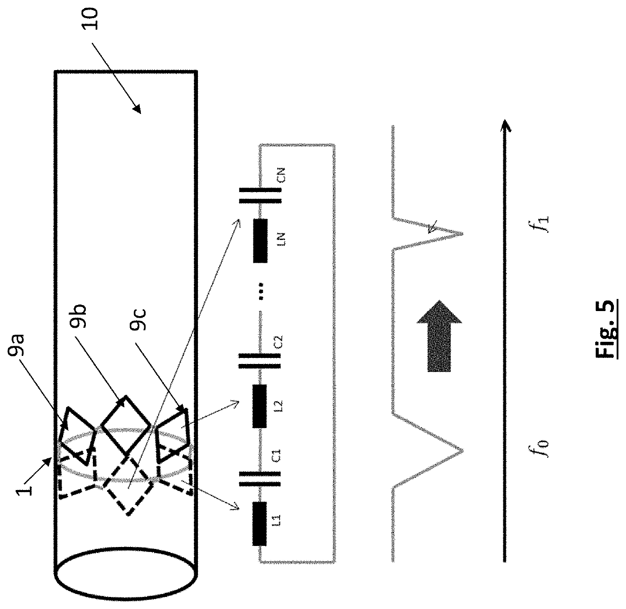 Implant with sensor assembly