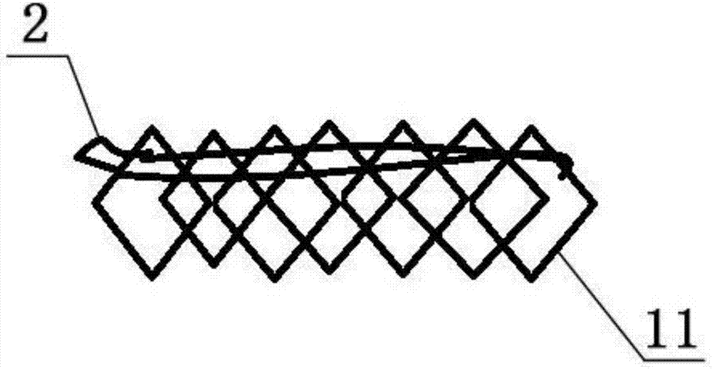 Loop-type temporary cerebrovascular stent