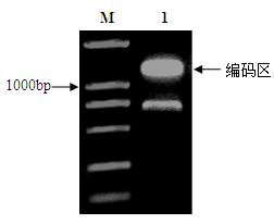 Squalene synthase gene of Panax japonicus and application of the gene