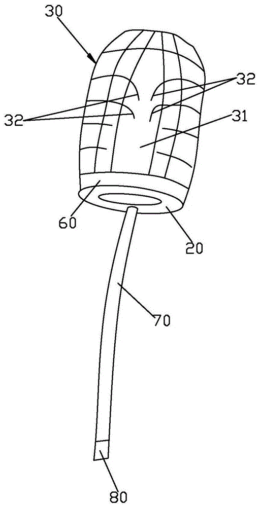 A balloon type partial renal blocker