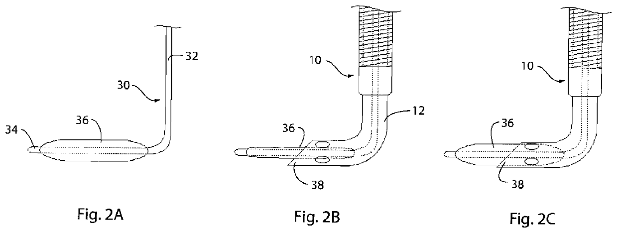 Balloon dilator