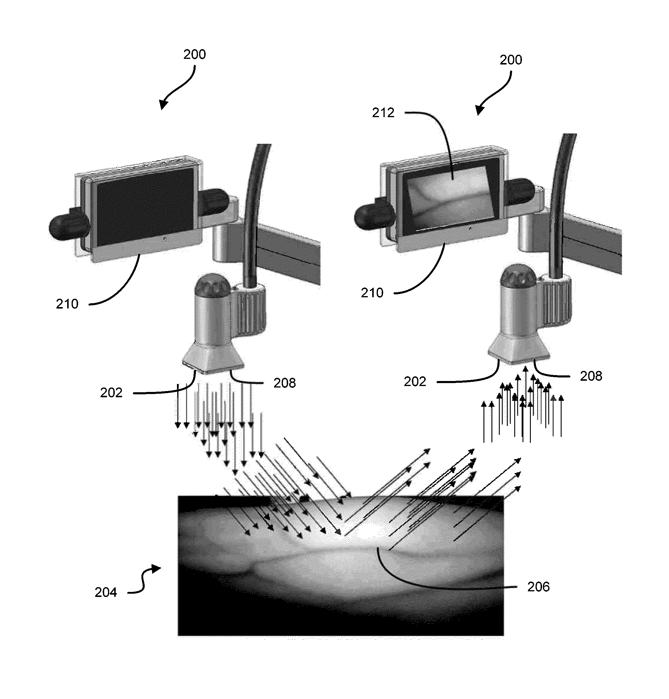 Vein imaging systems and methods