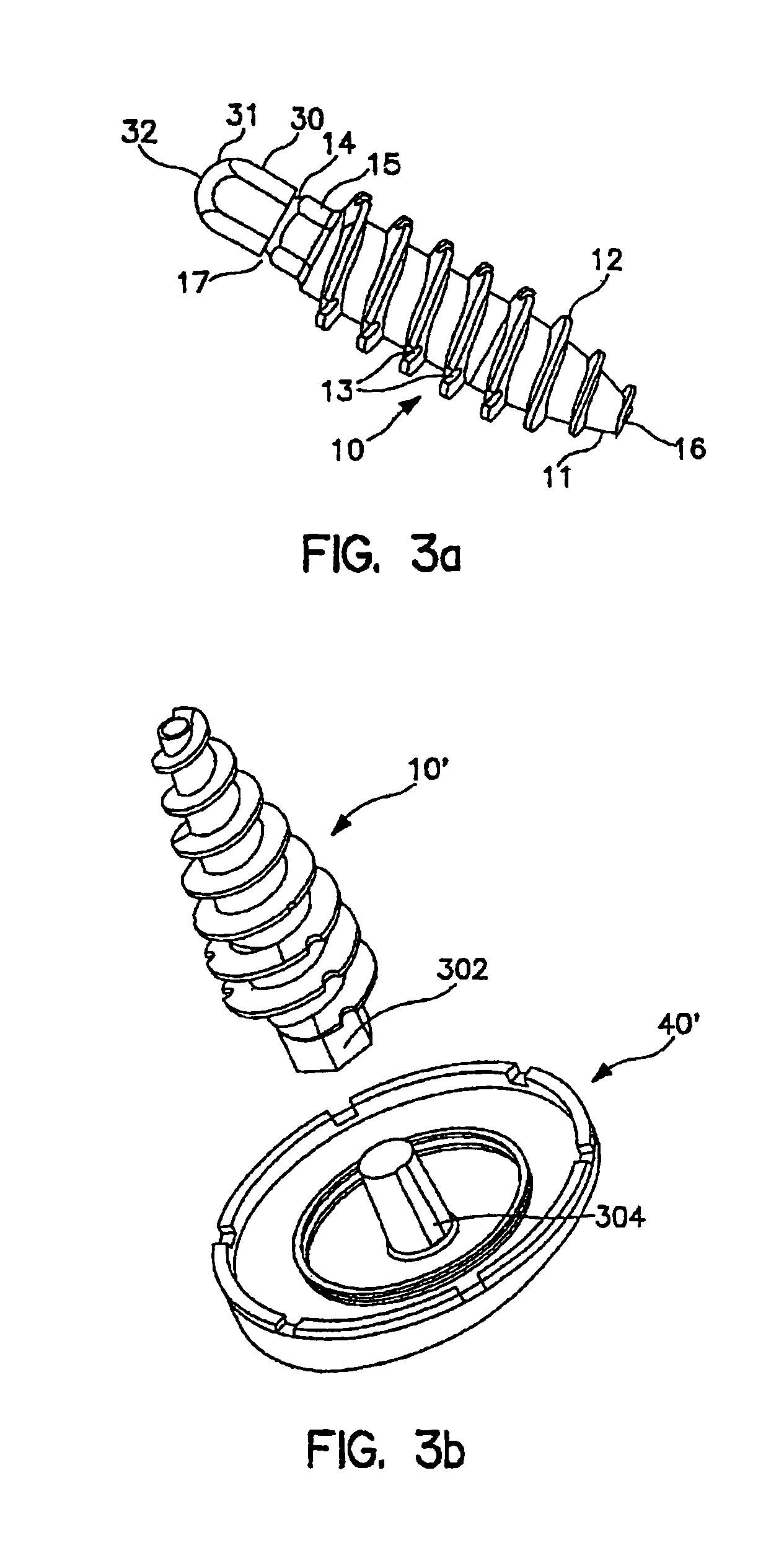 System and method for joint resurface repair