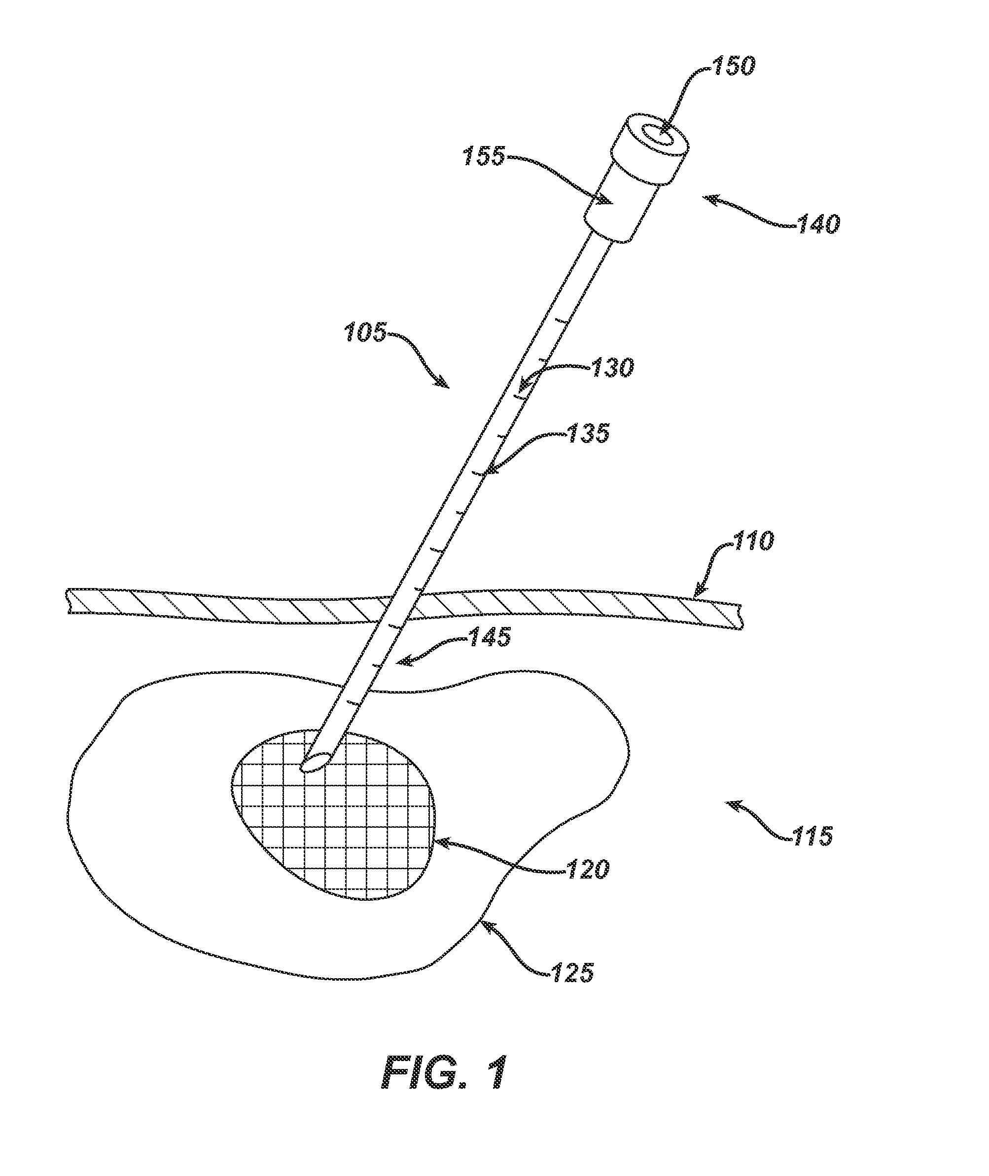 System and Method for Targeted Delivery of Therapeutic Agents to Tissue
