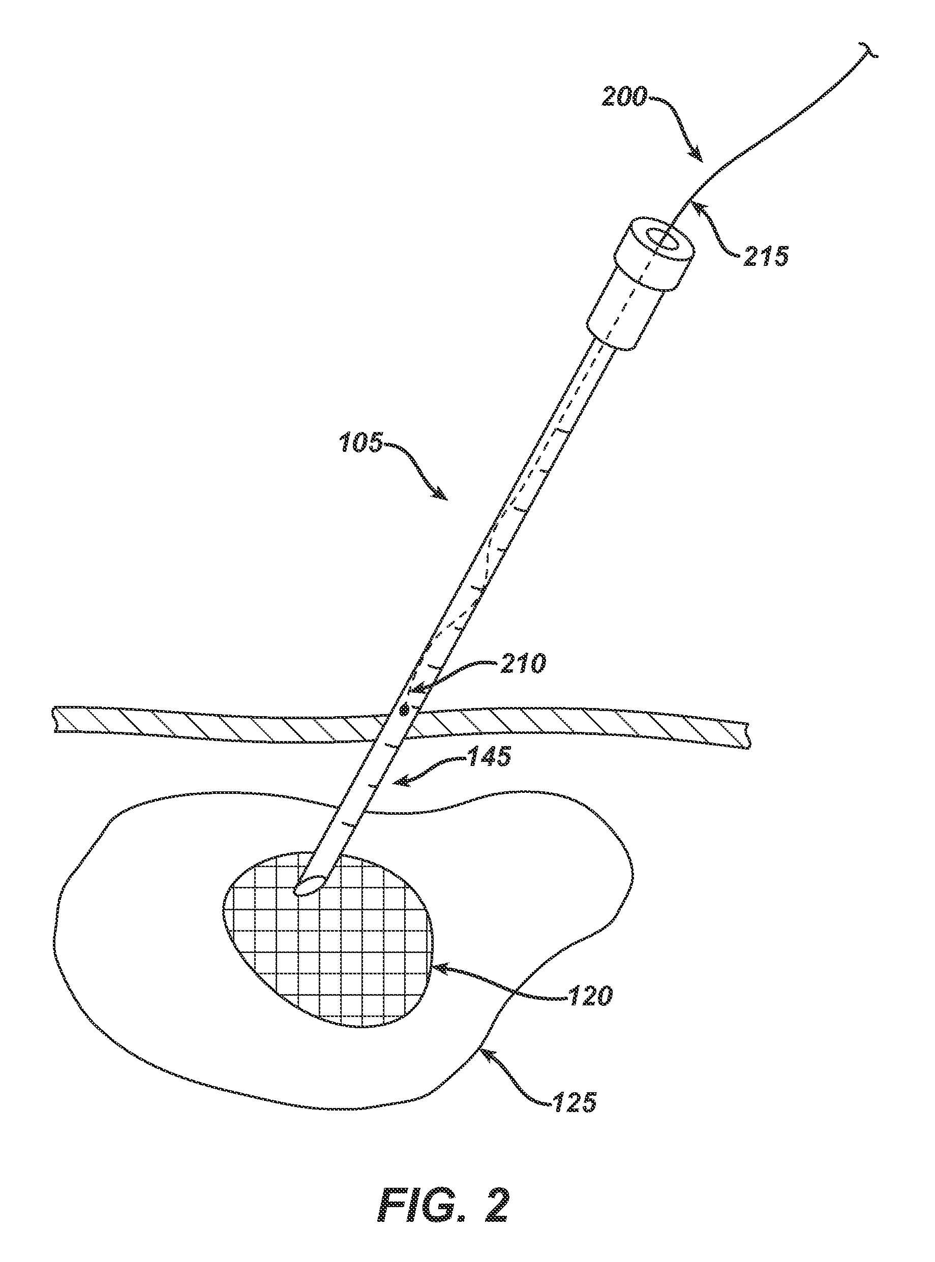 System and Method for Targeted Delivery of Therapeutic Agents to Tissue
