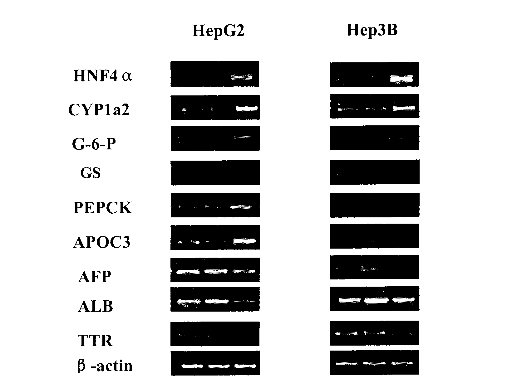 Treatment on human malignant solid tumor by HNF4 alpha inducement and differentiation