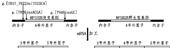 MFSD2B mutant gene and detection method thereof