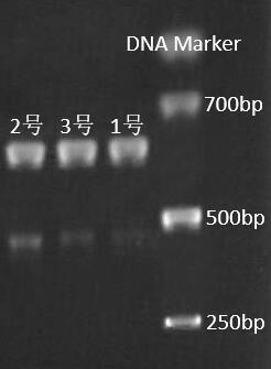 MFSD2B mutant gene and detection method thereof