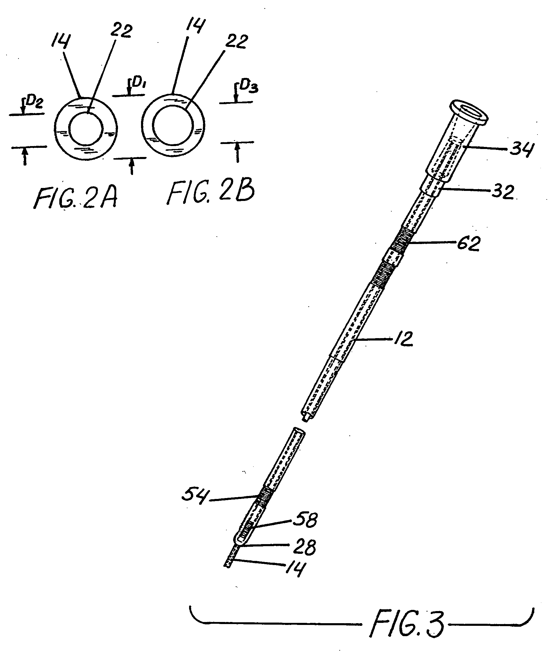 Catheter system for intracranial treatment