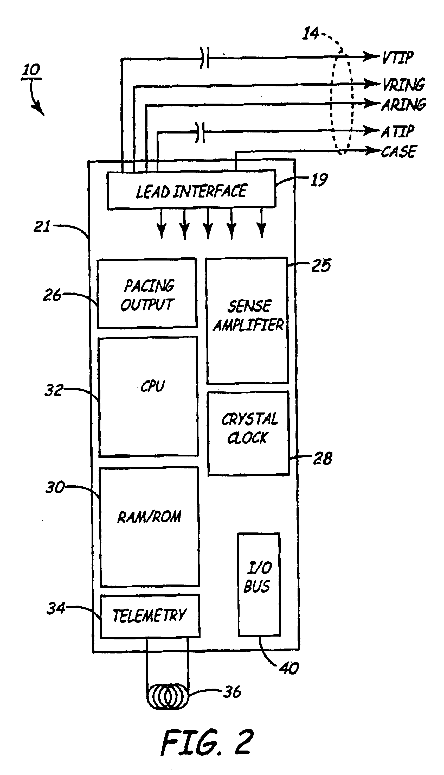 Method for stacking semiconductor die within an implanted medical device