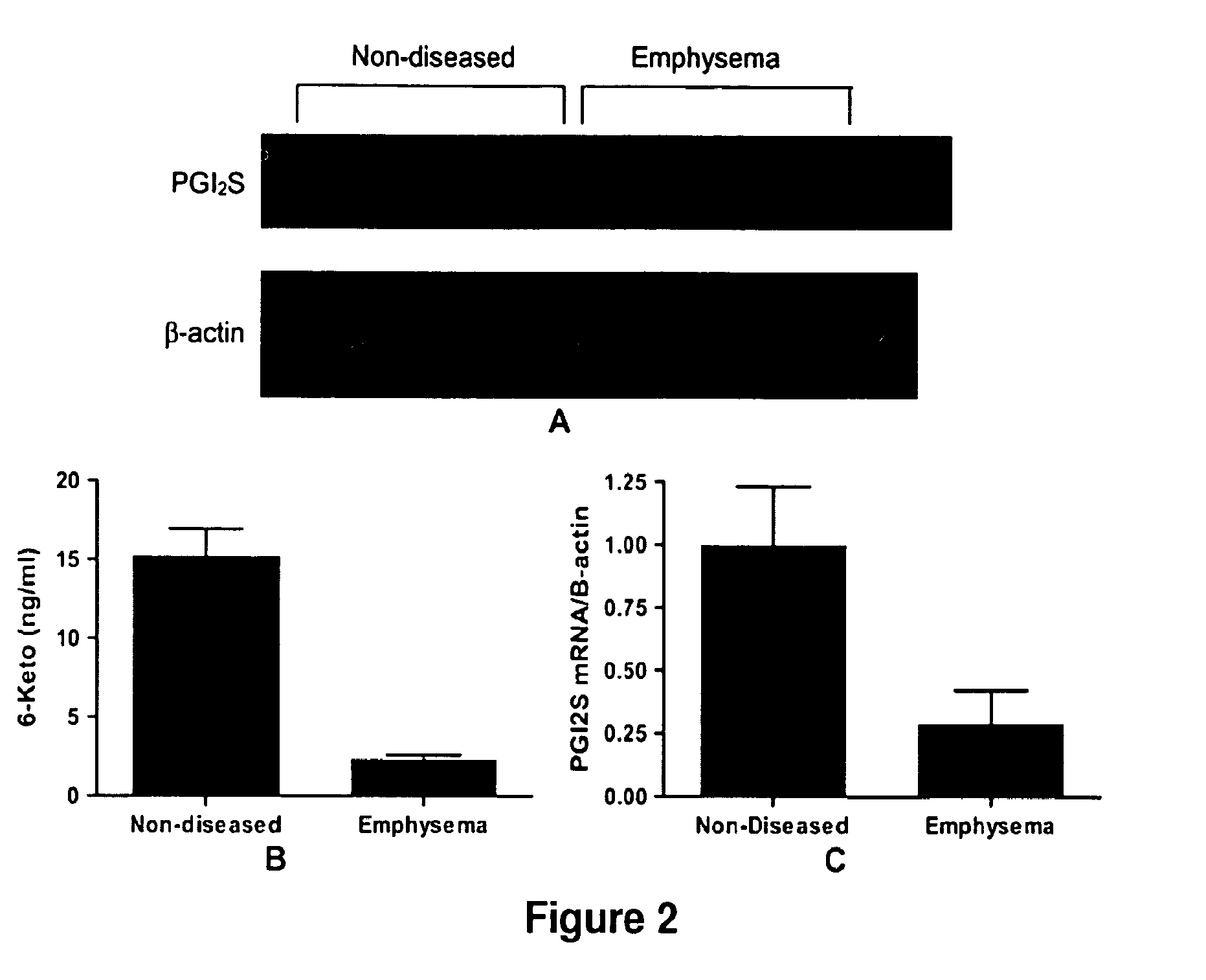 Treatment of COPD