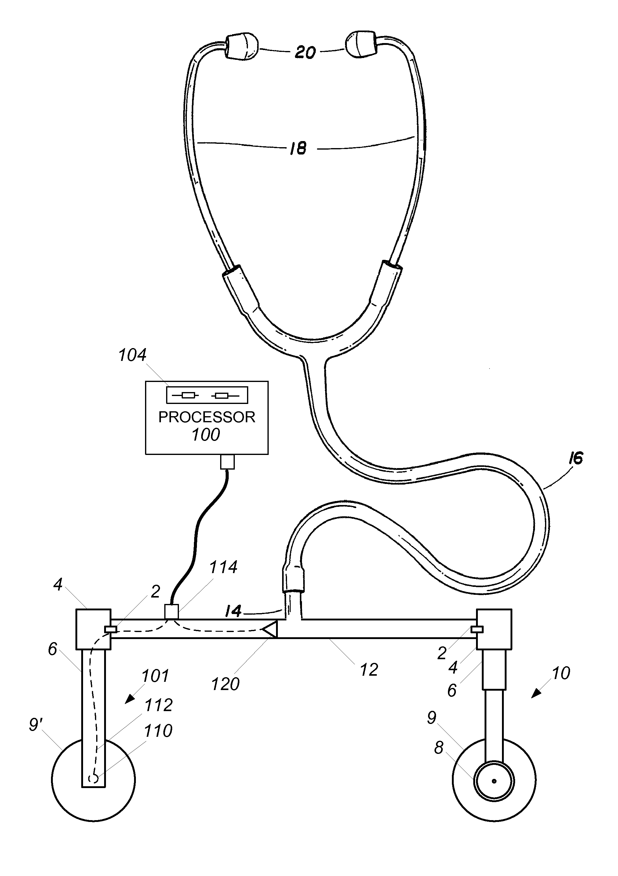 Dual-sensor stethoscope with electronic sensor
