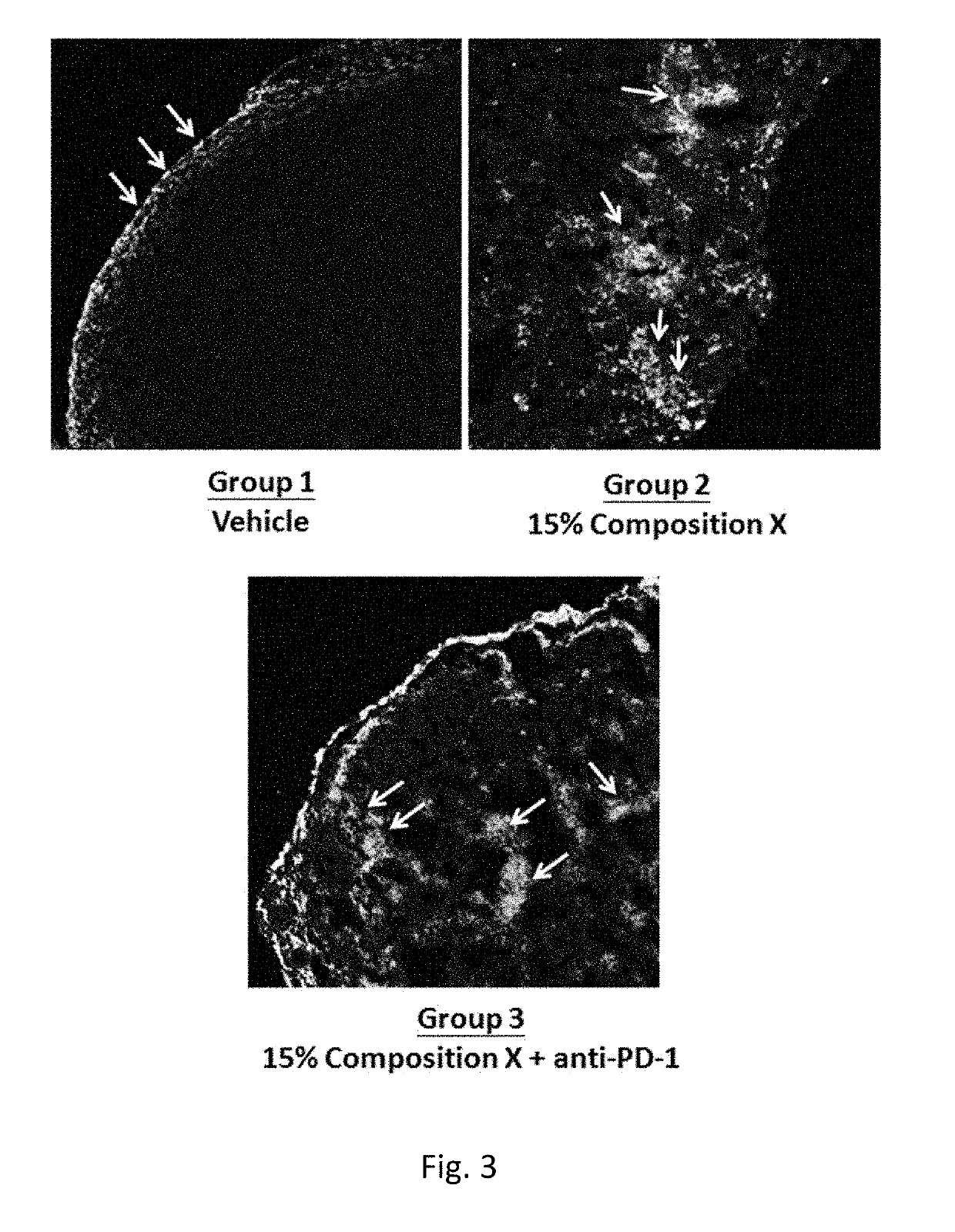 Method of activating tumor-infiltrating lymphocytes (TILS)