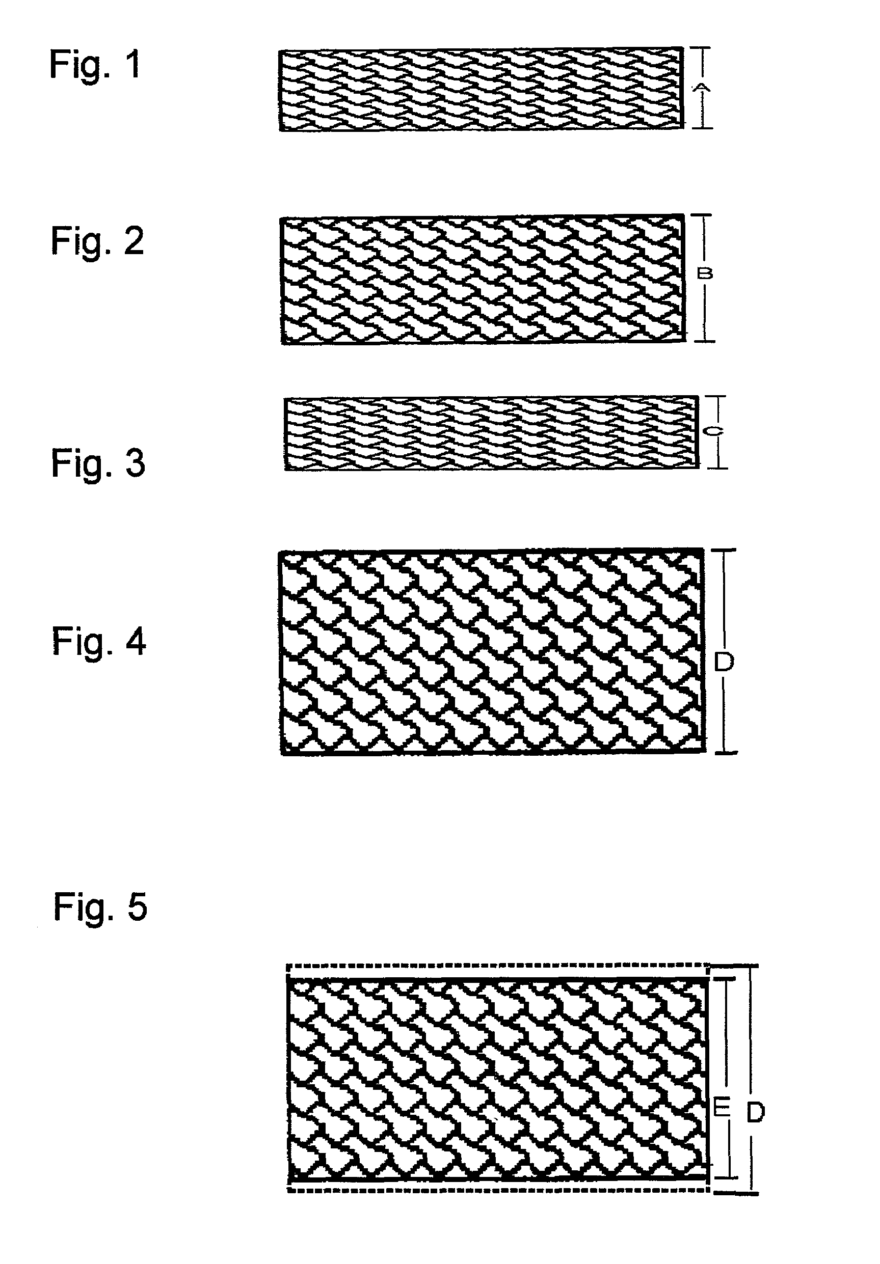 Balloon expandable polymer stent with reduced elastic recoil
