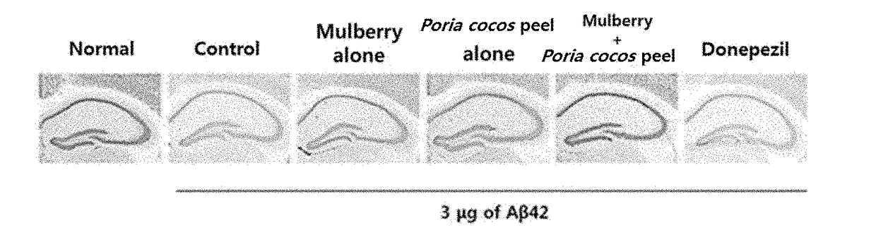 Composition containing mixed extract of mulberry and poria cocos bark for preventing, improving or treating neurodegenerative disorders