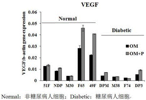 Application of PEDF in preparing medicine for diabetes bone tissue complication