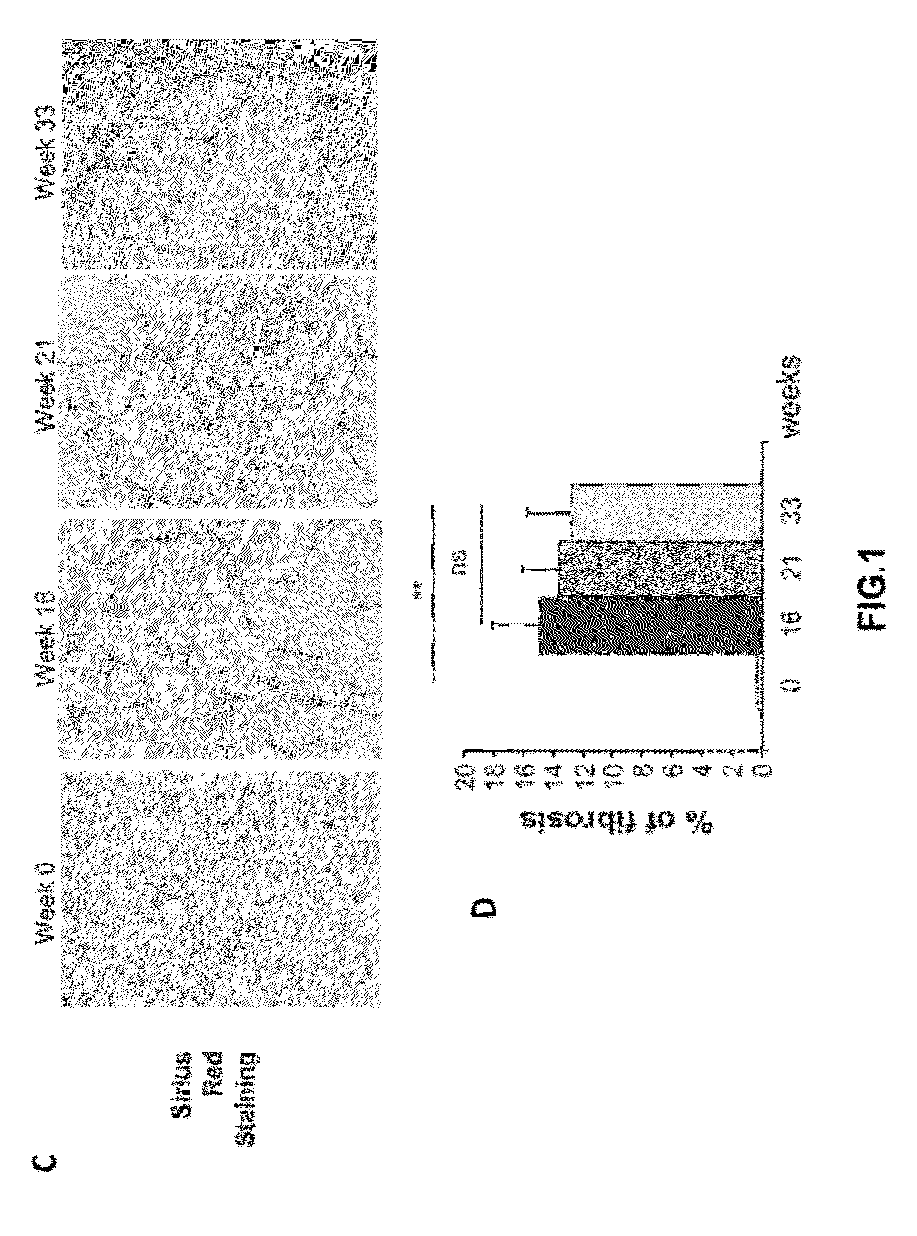 Methods and compositions for the treatment of cirrhosis and liver fibrosis