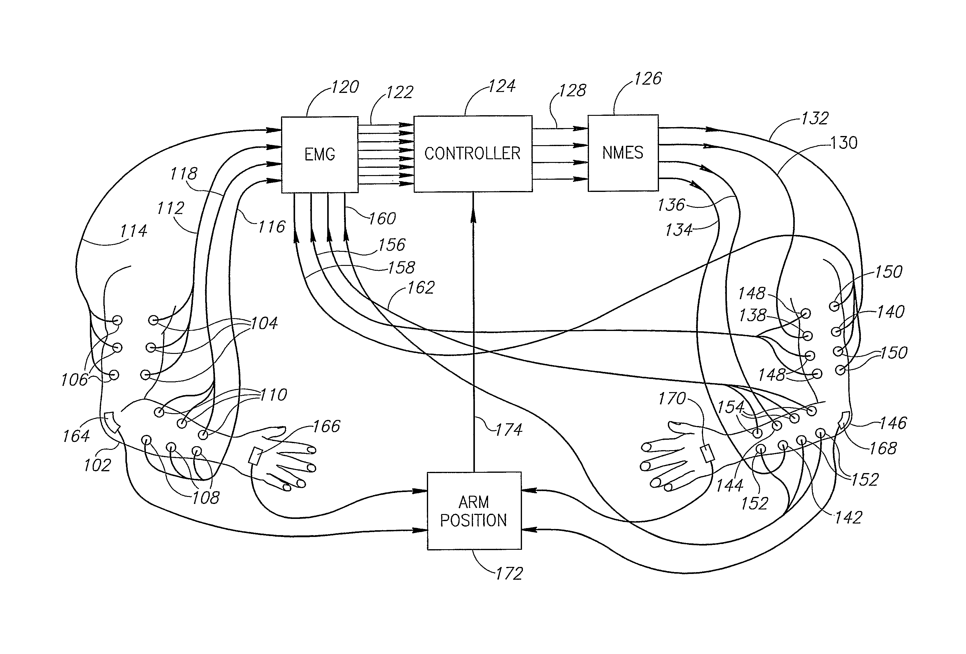 Neuromuscular stimulation