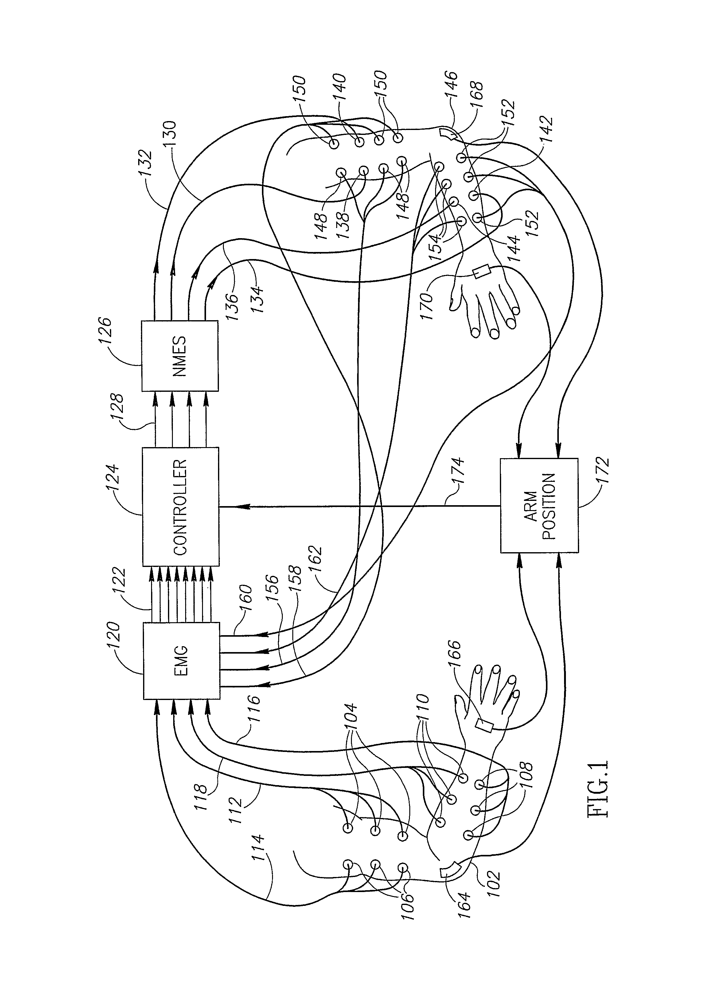 Neuromuscular stimulation