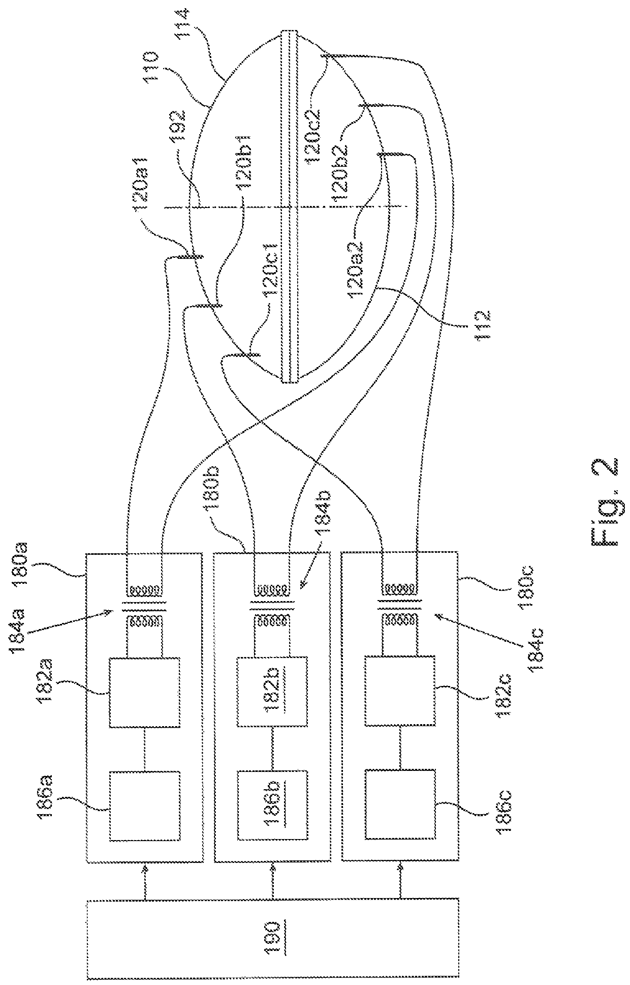 Plasma treating an implant