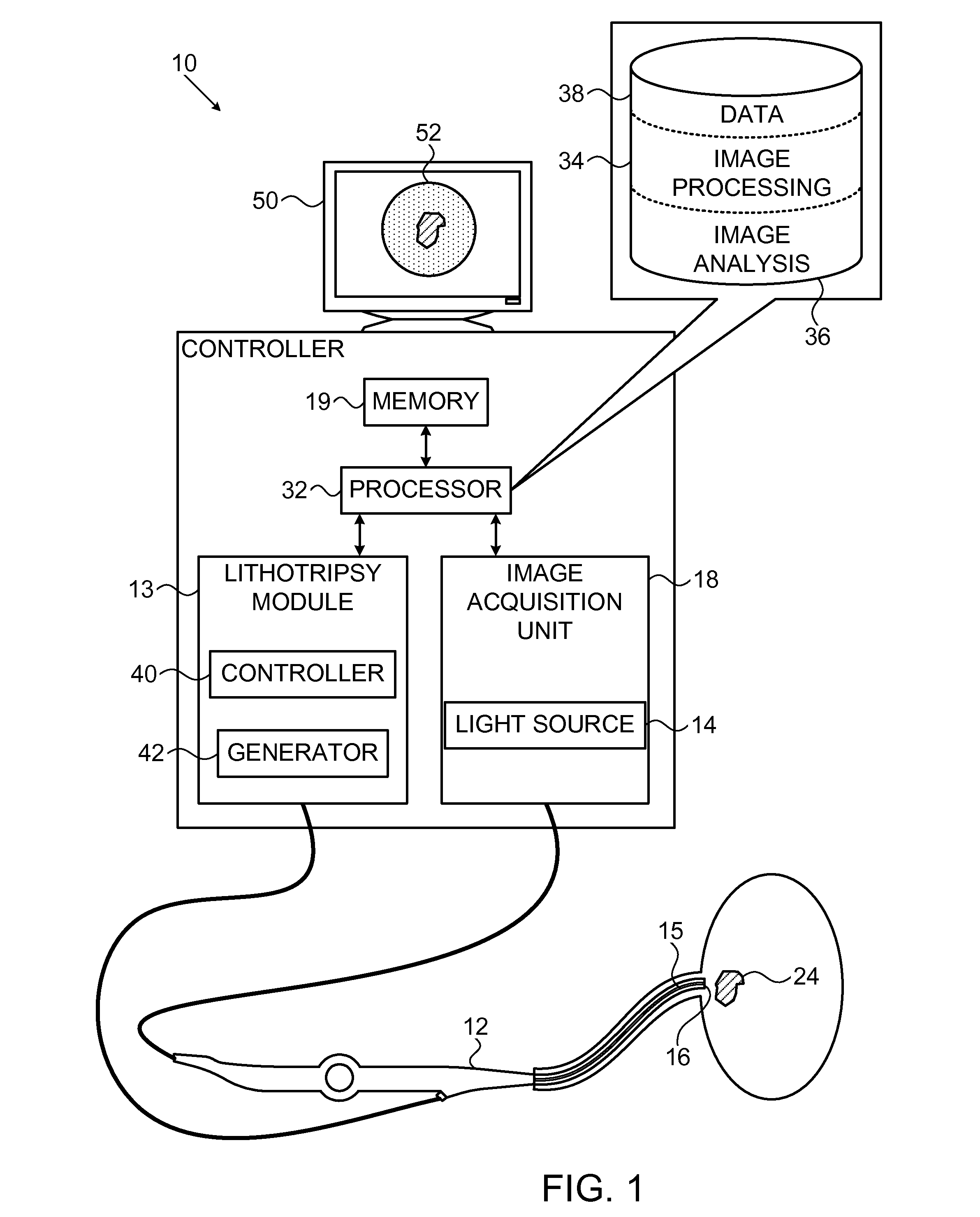 Computer aided image-based enhanced intracorporeal lithotripsy