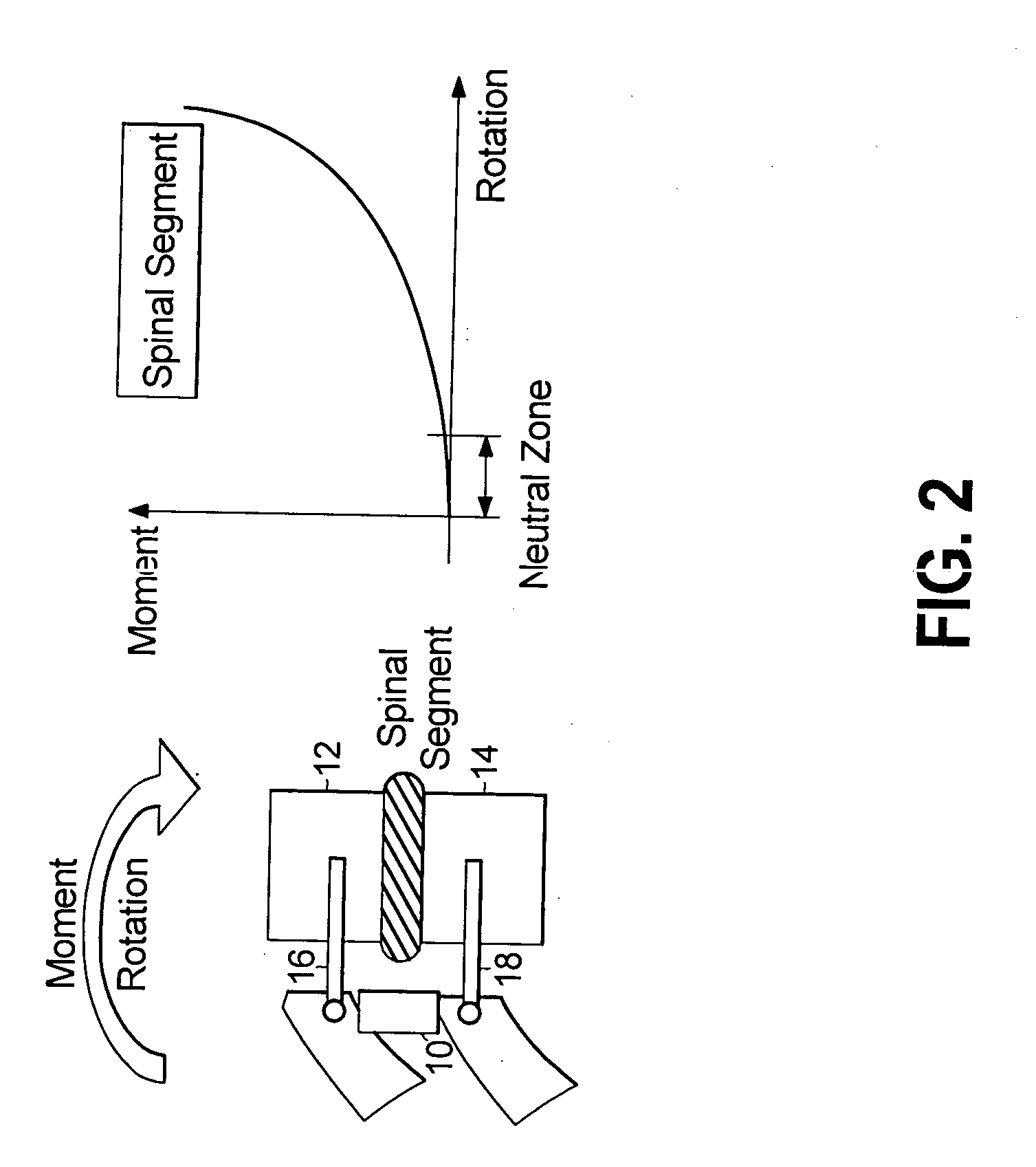 Pedicle screw devices, systems and methods having a preloaded set screw