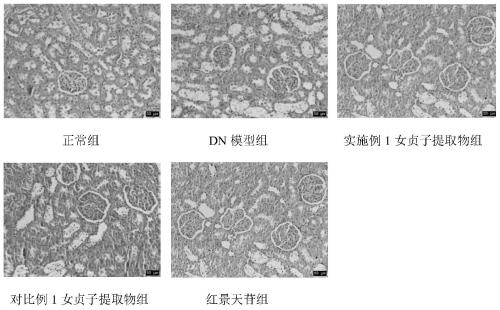 Anti-diabetic nephropathy (DN) glossy privet fruit extract as well as preparation method and application