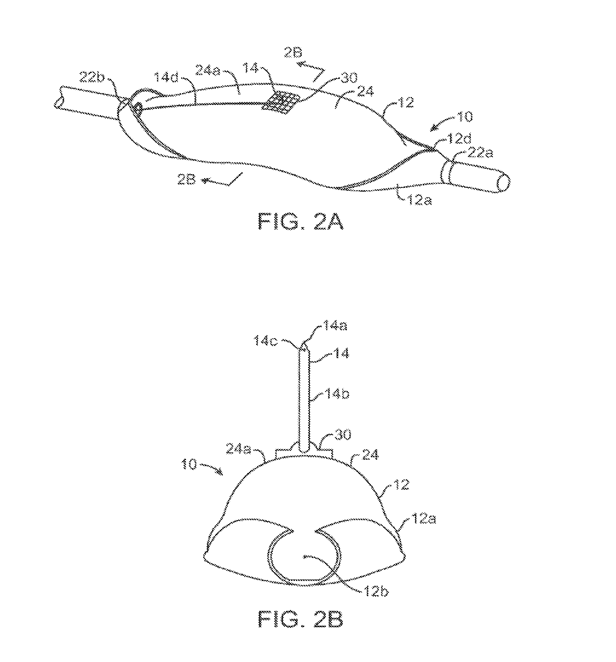 Systems and methods of treating malacia by local delivery of hydrogel to augment tissue