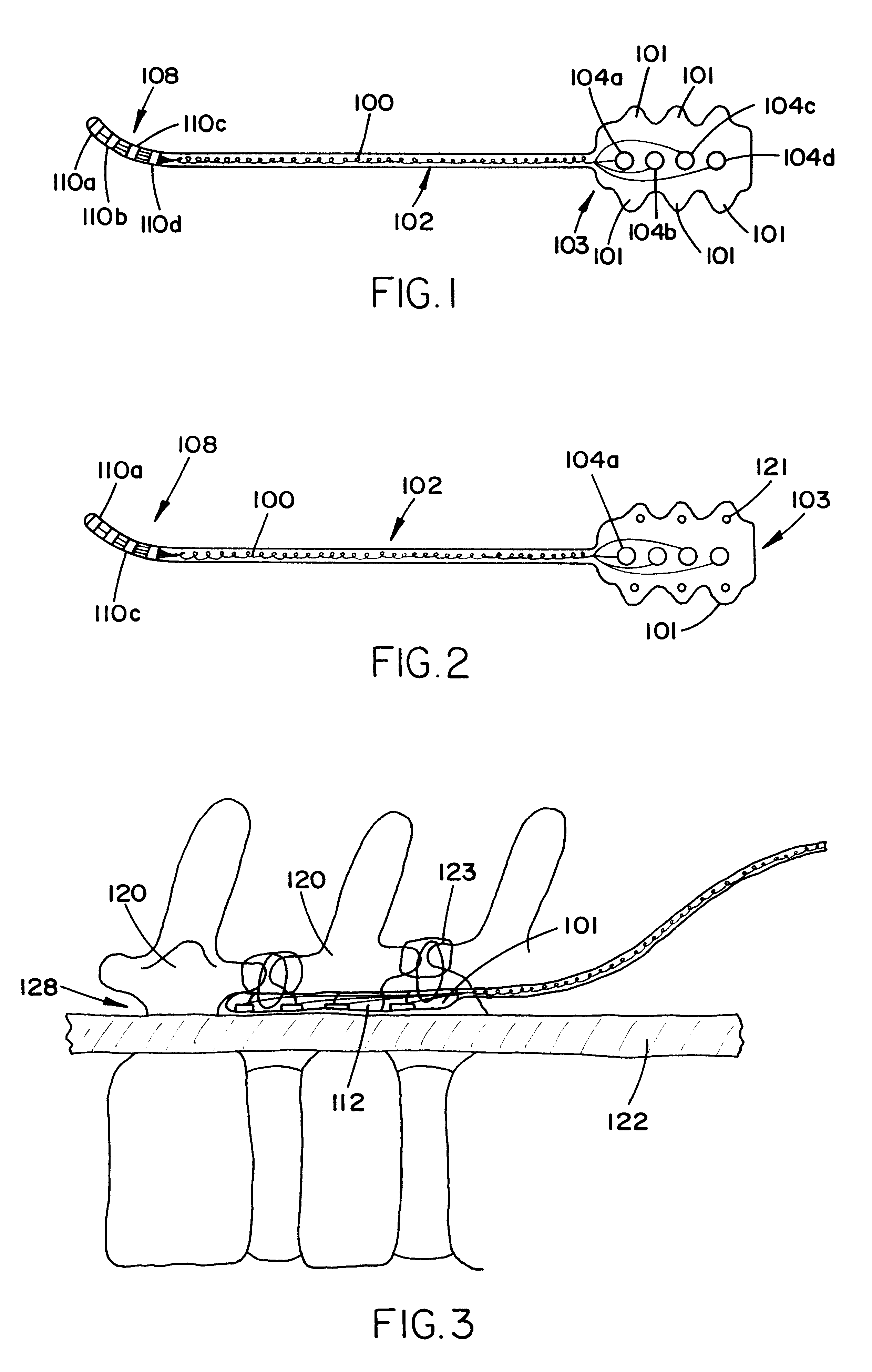 Spinal cord electrode assembly having laterally extending portions