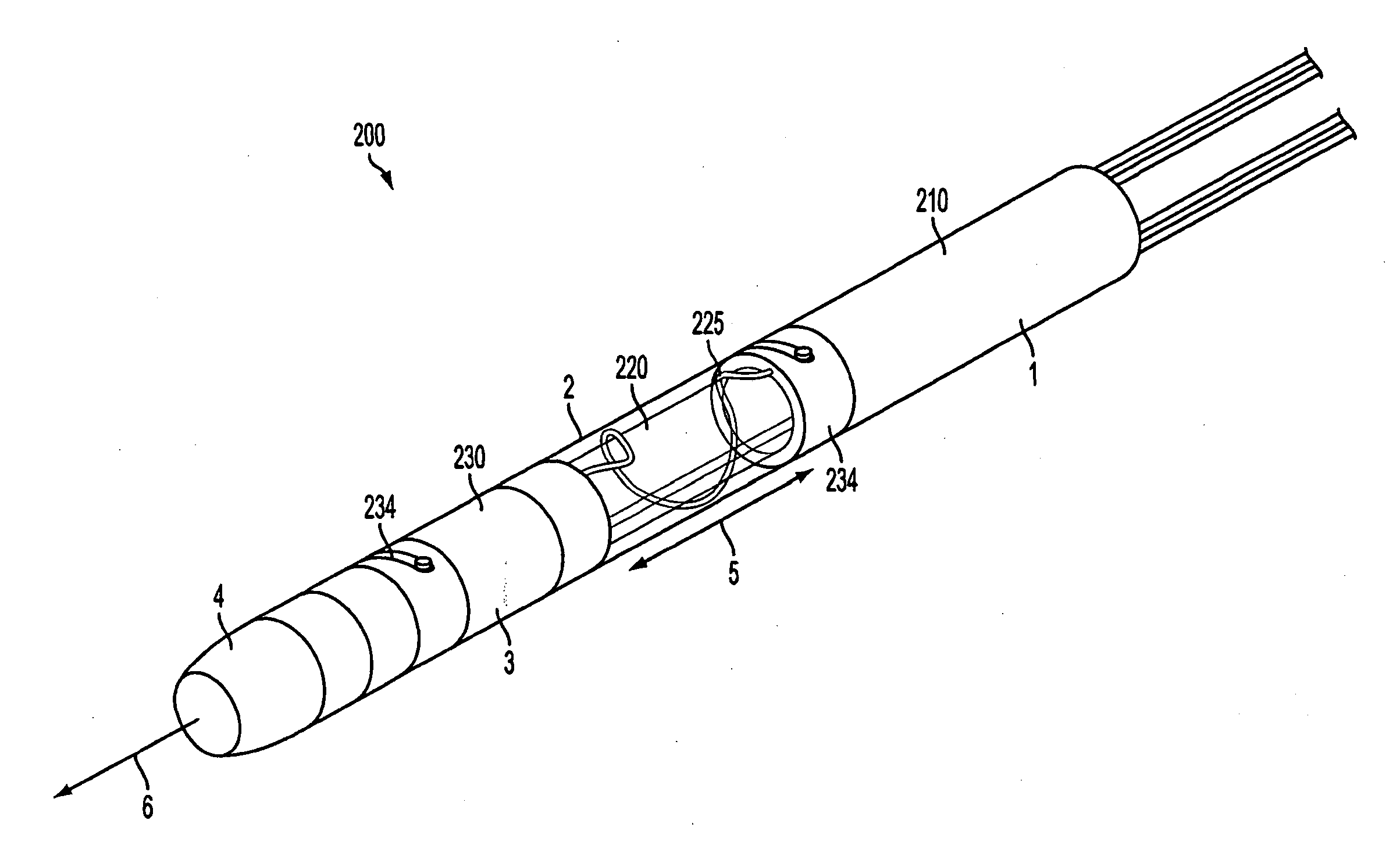 Lead extraction methods and apparatus