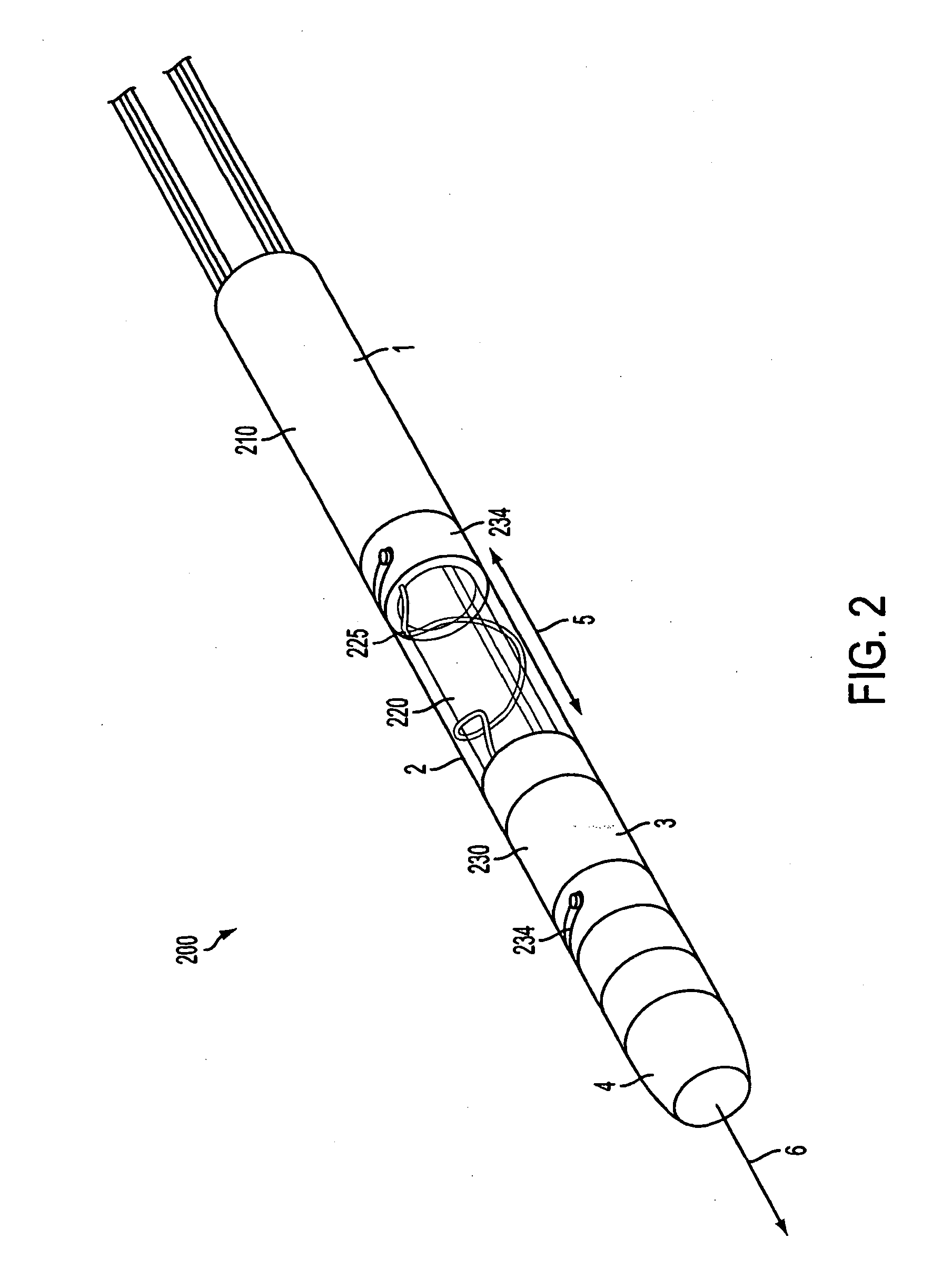 Lead extraction methods and apparatus