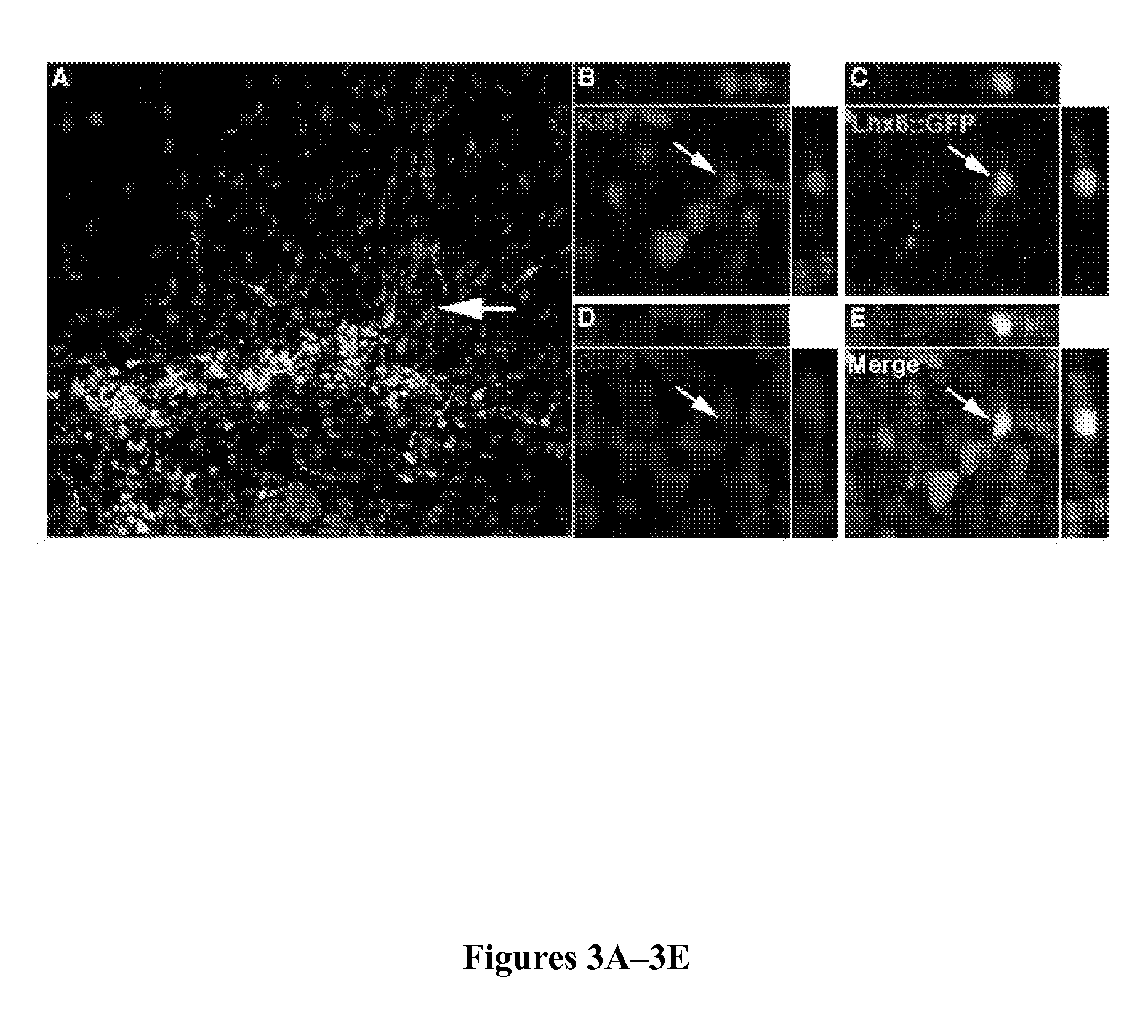Method to isolate, identify, and use embryonic stem cells directed to forebrain interneuron fate