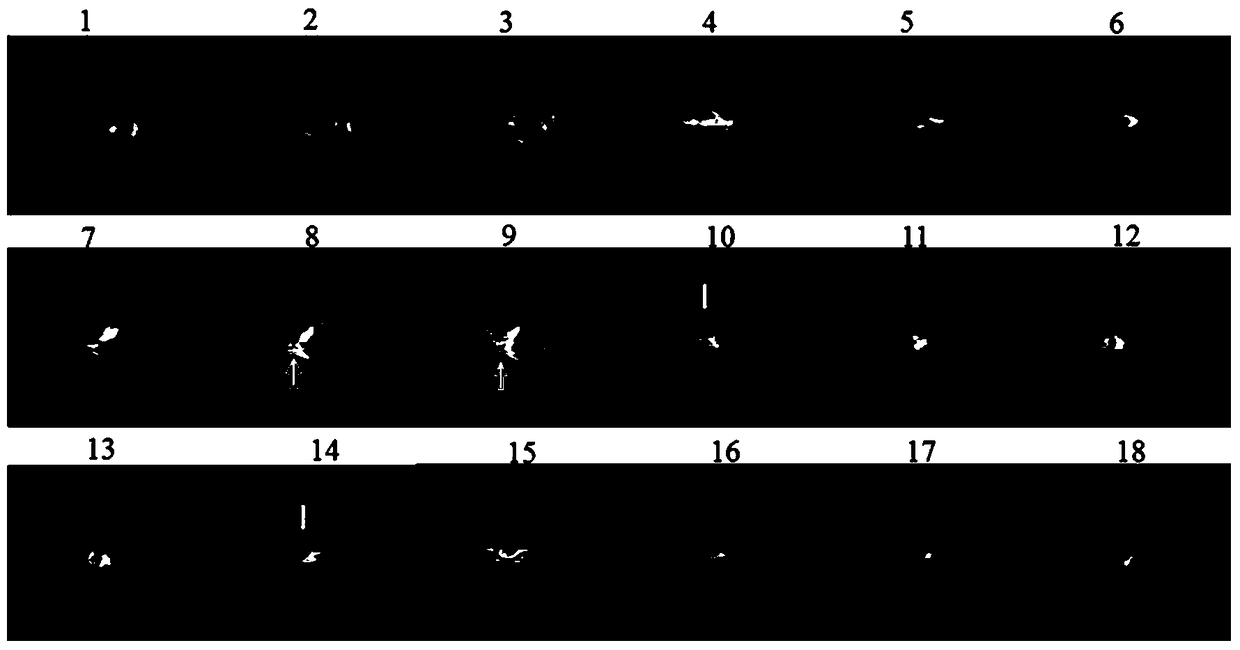 Method for non-destructive detection of fat volume in hepatopancreas and gonads of Chinese mitten crab