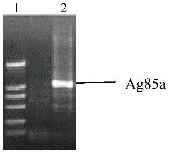 Therapeutic mycobacterium tuberculosis DNA vaccine and preparation method and application thereof